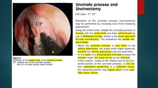 Anatomy of Internal Nose | PPTX