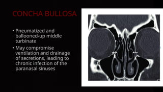 lateral wall of nose.pptx it is very important | PPTX