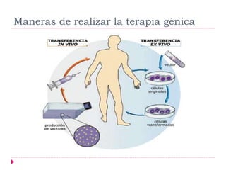Maneras de realizar la terapia génica
 