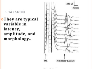 CHARACTER
They are typically
variable in
latency,
amplitude, and
morphology..
 