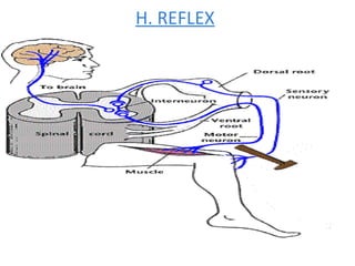 H. REFLEX
 