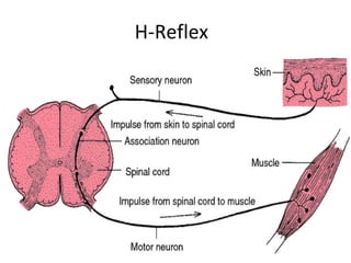 H-Reflex
•
 