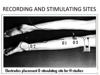 RECORDING AND STIMULATING SITES
 
