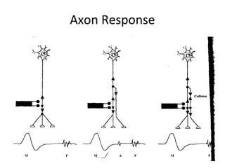 Axon Response
 