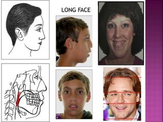LONG FACE
 