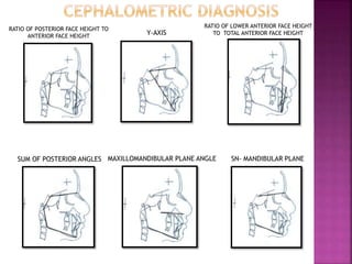 RATIO OF POSTERIOR FACE HEIGHT TO
ANTERIOR FACE HEIGHT
RATIO OF LOWER ANTERIOR FACE HEIGHT
TO TOTAL ANTERIOR FACE HEIGHTY-AXIS
SUM OF POSTERIOR ANGLES SN- MANDIBULAR PLANEMAXILLOMANDIBULAR PLANE ANGLE
 
