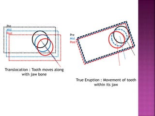Translocation : Tooth moves along
with jaw bone
True Eruption : Movement of tooth
within its jaw
Pre
Mid
Post
Pre
Mid
Post
 