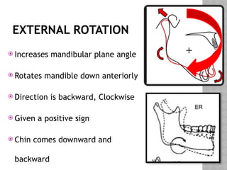 Maxillary Plane Rotation Later stages in development final (1)notes.pptx