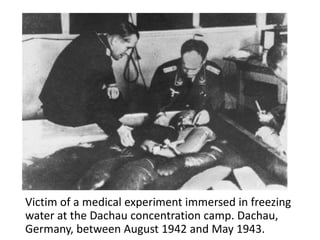 Victim of a medical experiment immersed in freezing
water at the Dachau concentration camp. Dachau,
Germany, between August 1942 and May 1943.
 