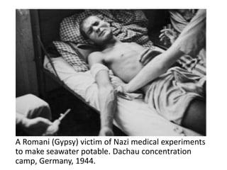 A Romani (Gypsy) victim of Nazi medical experiments
to make seawater potable. Dachau concentration
camp, Germany, 1944.
 