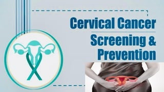 Cervical cancer , screening, management and prevention | PPTX