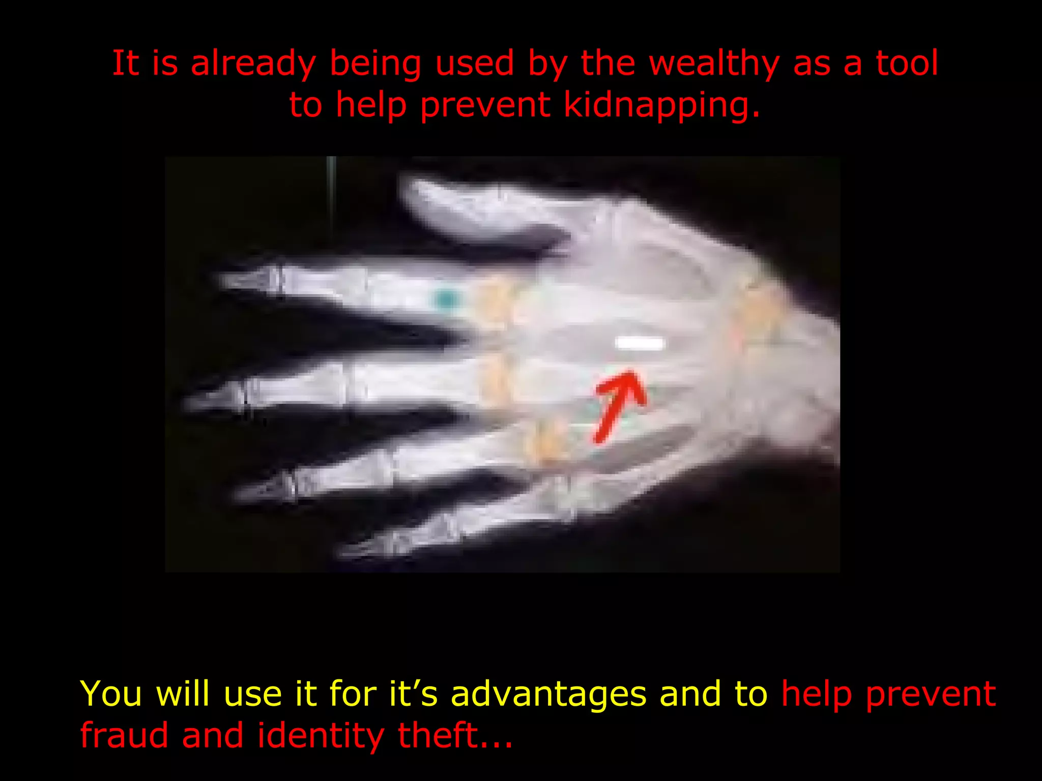 You will use it for it’s advantages and to  help prevent fraud and identity theft... It is already being used by the wealthy as a tool to help prevent kidnapping. 