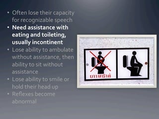 •  Often	
  lose	
  their	
  capacity	
  
   for	
  recognizable	
  speech	
  
•  Need	
  assistance	
  with	
  
   eating	
  and	
  toileting,	
  
   usually	
  incontinent	
  
•  Lose	
  ability	
  to	
  ambulate	
  
   without	
  assistance,	
  then	
  
   ability	
  to	
  sit	
  without	
  
   assistance	
  
•  Lose	
  ability	
  to	
  smile	
  or	
  
   hold	
  their	
  head	
  up	
  
•  Reﬂexes	
  become	
  
   abnormal	
  
 