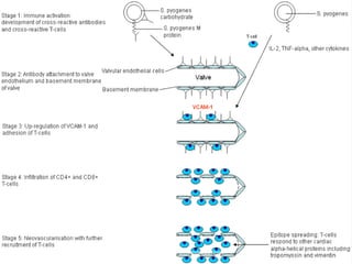 Latest developments in rheumatic fever
 