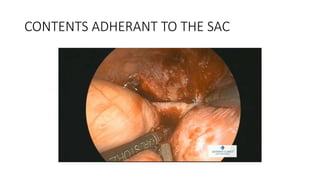 CONTENTS ADHERANT TO THE SAC
 