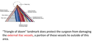 “Triangle of doom" landmark does protect the surgeon from damaging
the external iliac vessels, a portion of these vessels lie outside of this
area.
 