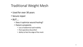 Traditional Weight Mesh
• Used for over 30 years
• Secure repair
• BUT….
• Does it optimize wound healing?
• Patient complaints
• Loss of abdominal wall mobility
• Post-operative discomfort
• Ability to feel the edge of the mesh
220
 