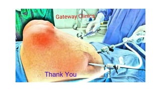 Latest in Laparoscopic Hernia surgery