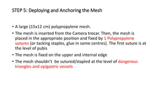 STEP 5: Deploying and Anchoring the Mesh
• A large (15x12 cm) polypropylene mesh.
• The mesh is inserted from the Camera trocar. Then, the mesh is
placed in the appropriate position and fixed by 1 Polypropylene
sutures (or tacking staples, glue in some centres). The first suture is at
the level of pubis
• The mesh is fixed on the upper and internal edge
• The mesh shouldn’t be sutured/stapled at the level of dangerous
triangles and epigastric vessels
 