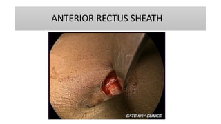 ANTERIOR RECTUS SHEATH
 