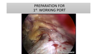 PREPARATION FOR
1st WORKING PORT
 