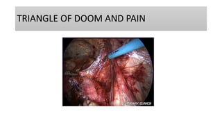 TRIANGLE OF DOOM AND PAIN
 
