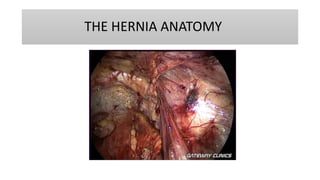 THE HERNIA ANATOMY
 