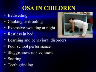 OSA IN CHILDREN
• Bedwetting
• Choking or drooling
• Excessive sweating at night
• Restless in bed
• Learning and behavioral disorders
• Poor school performance
• Sluggishness or sleepiness
• Snoring
• Teeth grinding
 
