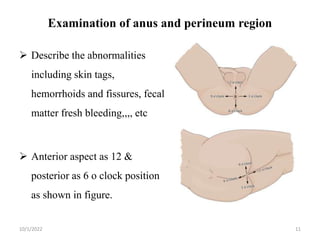 10/1/2022 11
Examination of anus and perineum region
 Describe the abnormalities
including skin tags,
hemorrhoids and fissures, fecal
matter fresh bleeding,,,, etc
 Anterior aspect as 12 &
posterior as 6 o clock position
as shown in figure.
 