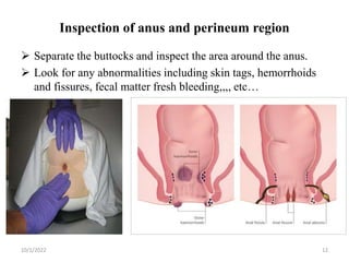 Inspection of anus and perineum region
 Separate the buttocks and inspect the area around the anus.
 Look for any abnormalities including skin tags, hemorrhoids
and fissures, fecal matter fresh bleeding,,,, etc…
10/1/2022 12
 