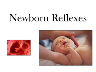 Newborn Reflexes
 