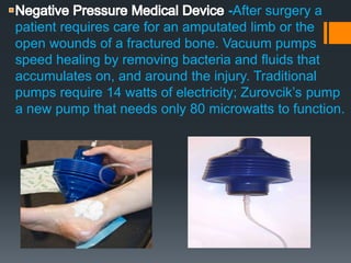 -After surgery a
patient requires care for an amputated limb or the
open wounds of a fractured bone. Vacuum pumps
speed healing by removing bacteria and fluids that
accumulates on, and around the injury. Traditional
pumps require 14 watts of electricity; Zurovcik’s pump
a new pump that needs only 80 microwatts to function.
 
