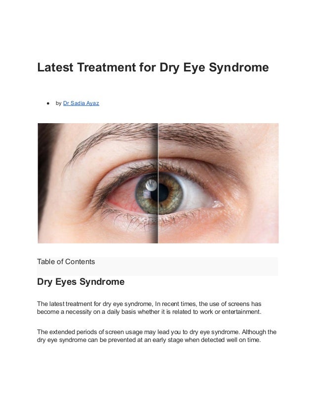 Latest Treatment for Dry Eye Syndrome
● by Dr Sadia Ayaz
Table of Contents
Dry Eyes Syndrome
The latest treatment for dry eye syndrome, In recent times, the use of screens has
become a necessity on a daily basis whether it is related to work or entertainment.
The extended periods of screen usage may lead you to dry eye syndrome. Although the
dry eye syndrome can be prevented at an early stage when detected well on time.
 