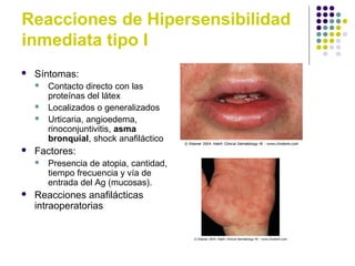Reacciones de Hipersensibilidad
inmediata tipo I
 Síntomas:
 Contacto directo con las
proteínas del látex
 Localizados o generalizados
 Urticaria, angioedema,
rinoconjuntivitis, asma
bronquial, shock anafiláctico
 Factores:
 Presencia de atopia, cantidad,
tiempo frecuencia y vía de
entrada del Ag (mucosas).
 Reacciones anafilácticas
intraoperatorias
 