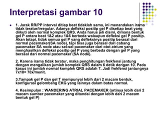 Interpretasi gambar 10
 1. Jarak RR/PP interval ditiap beat tidaklah sama, ini menandakan irama
tidak teratur/irregular. Adanya defleksi positip gel P disetiap beat yang
diikuti oleh normal komplek QRS. Anda harus jeli disini, dimana bentuk
gel P antara beat 1&2 atau 1&6 berbeda walaupun defleksi gel P positip.
Akan tetapi, tidak semua gel P yang defleksinya positip berasal dari
normal pacemaker(SA node), tapi bisa juga berasal dari cabang
pacemaker SA node atau sel-sel pacemaker dari otot atrium yang
menghasilkan defleksi positip gel P yang berbeda dengan gel P yang
berasal dari normal pacemaker (SA node).
2. Karena irama tidak teratur, maka penghitungan frekfensi jantung
dengan mengalikan jumlah komplek QRS dalam 6 detik dengan 10. Pada
kasus ini jumlah normal komplek QRS adalah 7. Jadi frekfensi jantungnya
7x10= 70x/menit.
3.Tampak gel P dan gel T mempunyai lebih dari 2 macam bentuk,
konfigurasi gelombang EKG yang lainnya dalam batas normal.
4. Kesimpulan : WANDERING ATRIAL PACEMAKER (artinya lebih dari 2
macam sumber pacemaker yang ditandai dengan lebih dari 2 macam
bentuk gel P)
 