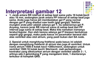 Interpretasi gambar 12
 1. Jarak antara RR interval di setiap beat sama yaitu 16 kotak kecil
atau 16 mm, sedangkan jarak antara PP interval di setiap beat juga
sama. Anda juga harus jeli membedakan gel P yang normal
dengan gel P yang disebut saw tooth (gigi gergaji). Sekilas
mungkin anda pikir adalah adanya gel T, itu sebenarnya gel P.
Anyway, karena jarak RR interval sama di setiap beat dan PP
interval juga sama di setiap beat. Maka kita namakan iramanya
teratur/regular. Dan oleh karena adanya gel P biarpun bentuknya
seperti gigi gergaji, maka pada kasus ini pacemaker berasal dari
atas ventrikel atau otot atrium, yang pasti bukan dari SA node.
2. Spesial untuk menghitung frekfensi pada kasus ini adalah
dengan menghitung frekfensi di atrium dan juga di ventrikel. Untuk
irama atrium 1500:5 kotak kecil =300x/menit, sedangkan untuk
ventrikel 1500:16 kotak kecil= 94x/menit. Jadi perbandingan
kontraksi yang dikeluarkan atrium dengan ventrikel adalah 3 : 1,
artinya ada 2 gelombang P yang mengalami blok, 1 diantaranya
terkubur di komplek QRS.
 