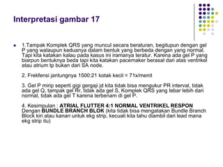 Interpretasi gambar 17
 1.Tampak Komplek QRS yang muncul secara beraturan, begitupun dengan gel
P yang walaupun keduanya dalam bentuk yang berbeda dengan yang normal.
Tapi kita katakan kalau pada kasus ini iramanya teratur. Karena ada gel P yang
biarpun bentuknya beda tapi kita katakan pacemaker berasal dari atas ventrikel
atau atrium tp bukan dari SA node.
2. Frekfensi jantungnya 1500:21 kotak kecil = 71x/menit
3. Gel P mirip seperti gigi gergaji jd kita tidak bisa mengukur PR interval, tidak
ada gel Q, tampak gel Rr, tidak ada gel S, Komplek QRS yang lebar lebih dari
normal, tidak ada gel T karena terbenam di gel P.
4. Kesimpulan : ATRIAL FLUTTER 4:1 NORMAL VENTRIKEL RESPON
Dengan BUNDLE BRANCH BLOK (kita tidak bisa mengatakan Bundle Branch
Block kiri atau kanan untuk ekg strip, kecuali kita tahu diambil dari lead mana
ekg strip itu)
 