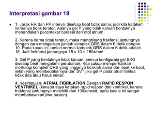 Interpretasi gambar 18
 1. Jarak RR dan PP interval disetiap beat tidak sama, jadi kita katakan
iramanya tidak teratur. Adanya gel P yang tidak karuan bentuknya
menandakan pacemaker berasal dari otot atrium.
2. Karena irama tidak teratur, maka menghitung frekfensi jantungnya
dengan cara mengalikan jumlah komplek QRS dalam 6 detik dengan
10. Pada kasus ini jumlah normal komplek QRS dalam 6 detik adalah
18. Jadi frekfensi jantungnya 18 x 10 = 180x/mnt.
3. Gel P yang bentuknya tidak karuan, semua konfigurasi gel EKG
disetiap beat mengalami perubahan. Kita cukup memperhatikan
morfologi komplek QRS yang tingginya tidaklah sama dari beat ke beat,
inilah yang membedakannya dari SVT jika gel P pada atrial fibrilasi
tidak ada atau halus sekali.
4. Kesimpulan: ATRIAL FIBRILATION Dengan RAPID RESPON
VENTRIKEL (kenapa saya katakan rapid respon dari ventrikel, karena
frekfensi jantungnya melebihi dari 100x/menit, pada kasus ini sangat
membahayakan jiwa pasien)
 
