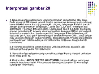 Interpretasi gambar 20
 1. Saya rasa anda sudah mahir untuk menentukan irama teratur atau tidak.
Pada kasus ini RR interval tampak teratur, sebenarnya kalau anda ukur dengan
benar tidaklah sama. Anda juga mungkin bingung dengan gel P disini, iya kan?
Jangan panic,perhatikan dengan jeli....pada beat 2,3,4 dan 7,8 tampak ada
gelombang P dengan defleksi negatif. Lihat juga di beat 5 & 6 tidak ditemukan
adanya gelombang P. Anyway kita mendapatkan komplek QRS di semua beat.
Kalau anda menemukan kasus seperti ini, dengan gel P berdefleksi negatif,
tidak ada gel P, atau gel P defleksi negatif setelah komplek QRS....anda jangan
ragu untuk mengatakan irama ini berasal dari pacemaker AV node atau daerah
junction dengan catatan adanya normal komplek QRS atau dengan bundle
branch blok.
2. Frekfensi jantungnya jumlah komplek QRS dalam 6 deti adalah 8, jadi
frekfensi jantungnya 8 x 10 = 80x/menit
3. Semua konfigurasi gelombang normal kecuali gel P yang menjadi perhatian
disini (baca point 1).
4. Kesimpulan : ACCELERATED JUNCTIONAL karena frekfensi jantungnya
melebihi impuls normal di AV node atau daerah junction (40 - 60 x/mnt) tapi
kurang dari 100x/menit.
 