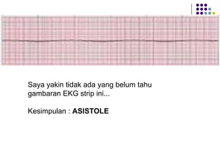 Saya yakin tidak ada yang belum tahu
gambaran EKG strip ini...
Kesimpulan : ASISTOLE
 