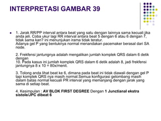 INTERPRETASI GAMBAR 39
 1. Jarak RR/PP interval antara beat yang satu dengan lainnya sama kecuali jika
anda jeli. Coba ukur lagi RR interval antara beat 5 dengan 6 atau 6 dengan 7,
tidak sama kan? ini menunjukan irama tidak teratur.
Adanya gel P yang bentuknya normal menandakan pacemaker berasal dari SA
node.
2. Frekfensi jantungnya adalah mengalikan jumlah komplek QRS dalam 6 detik
dengan
10. Pada kasus ini jumlah komplek QRS dalam 6 detik adalah 8, jadi frekfensi
jantungnya 8 x 10 = 80x/menit.
3. Tolong anda lihat beat ke 6, dimana pada beat ini tidak diawali dengan gel P
tapi komplek QRS nya masih normal.Semua konfigurasi gelombang masih
dalam batas normal kecuali PR interval yang memanjang dengan jarak yang
sama di setiap beat.
4. Kesimpulan : AV BLOK FIRST DEGREE Dengan 1 Junctianal ekstra
sistole/JPC dibeat 6
 