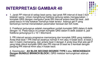 INTERPRETASI GAMBAR 40
 1. Jarak PP interval di setiap beat sama, tapi jarak RR interval di beat 3 & 4
tidaklah sama. Untuk menghitung frekfensi jantung selalu menggunakan
komplek QRS dengan mengukur jarak RR interval antara beat ke beat. Jadi
pada kasus ini kita katakan iramanya tidak teratur. Adanya gel P yang
bentuknya normal menandakan pacemaker berasal dari SA node.
2. Frekfensi jantungnya adalah mengalikan jumlah komplek QRS dalam 6 detik
dengan 10. Pada kasus ini jumlah komplek QRS dalam 6 detik adalah 6, jadi
frekfensi jantungnya 6 x 10 = 60x/menit.
3. PR interval secara progresive memanjang dan komplek QRS yang melebar,.
Anda lihat beat 1 PR interval awalnya normal 4 mm atau 4 kotak kecil, di beat 2
dan 3 makin memanjang, dan antara beat 3 dengan 4 anda bisa lihat ada gel P
yang tidak diikuti komplek QRS dan PR interval di beat ke 5 kembali dengan
panjang PR interval 4mm atau 4 kotak kecil.
4. Kesimpulan : AV BLOK SECOND DEGREE TYPE I atau WENCKEBACH
Dengan BUNDLE BRANCH BLOCK ( QRS melebar kemungkinan adanya
BBB)
 