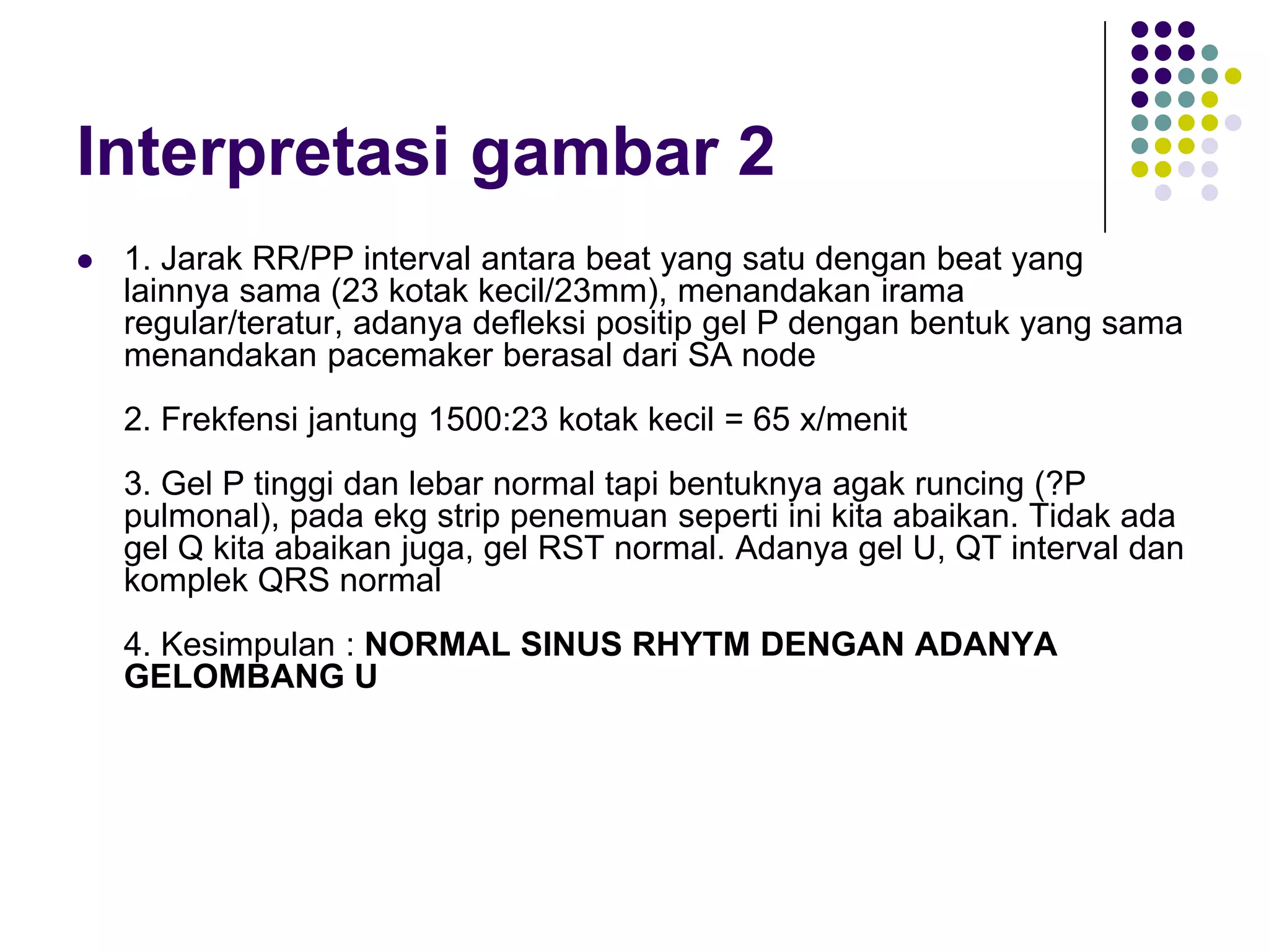 Rst Normal And Rst Inverse Latihan EKG Strip | PDF