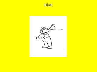 ictus
 