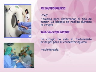 DIAGNOSTICO
•TAC
• biopsia para determinar el tipo de
tumor. La biopsia se realiza durante
la cirugía
TRATAMIENTO
•la cirugía ha sido el tratamiento
principal para el craneofaringioma.
•radioterapia
 