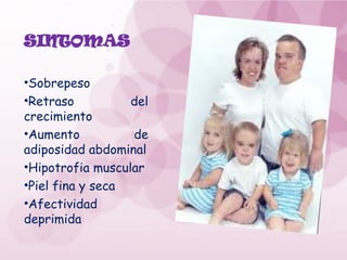 SINTOMAS
•Sobrepeso
•Retraso del
crecimiento
•Aumento de
adiposidad abdominal
•Hipotrofia muscular
•Piel fina y seca
•Afectividad
deprimida
 