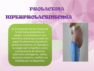 PROLACTINA
HIPERPROLACTINECMIA
 