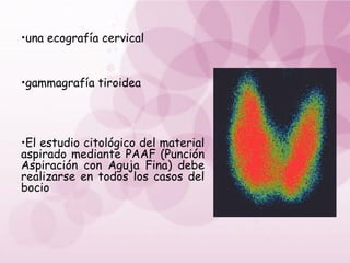 •una ecografía cervical
•gammagrafía tiroidea
•El estudio citológico del material
aspirado mediante PAAF (Punción
Aspiración con Aguja Fina) debe
realizarse en todos los casos del
bocio
 