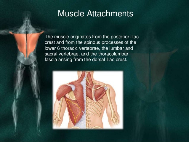 Latissimus dorsi flap for reconstruction in head and neck deffects