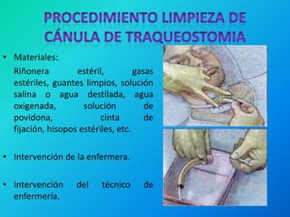 • Materiales:
  Riñonera         estéril,         gasas
  estériles, guantes limpios, solución
  salina o agua destilada, agua
  oxigenada,         solución          de
  povidona,               cinta        de
  fijación, hisopos estériles, etc.

• Intervención de la enfermera.

• Intervención      del   técnico     de
  enfermería.
 